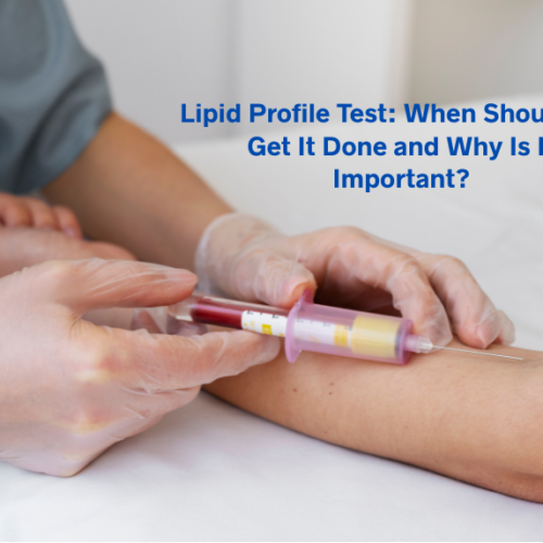 Lipid Profile Test