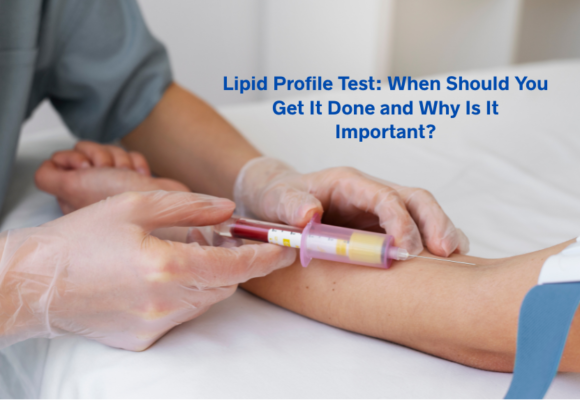 Lipid Profile Test