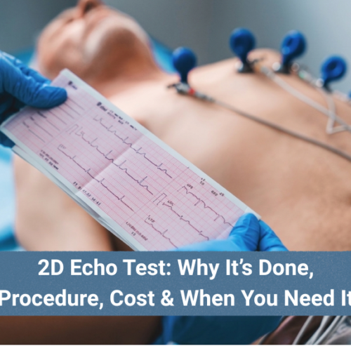 2D Echocardiography test