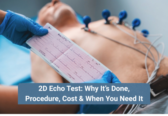 2D Echocardiography test