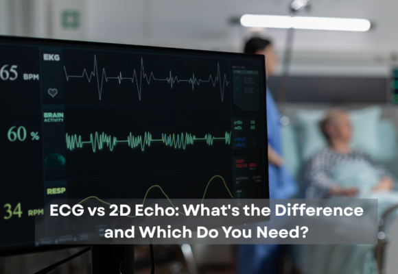 ECG vs 2D Echo Test