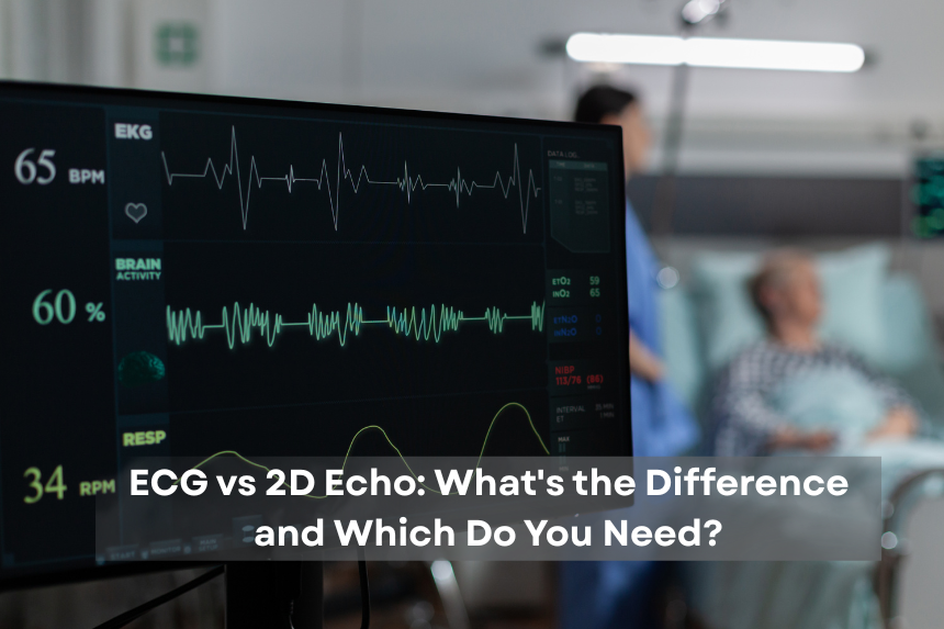 ECG vs 2D Echo Post ECG vs 2D Echo Test