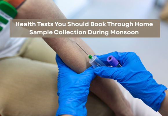 Home Sample Collection During Monsoon