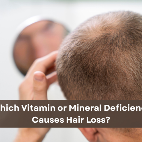 Vitamin or Mineral Deficiency Causes Hair Loss