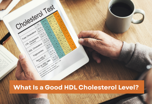 Good HDL Cholesterol